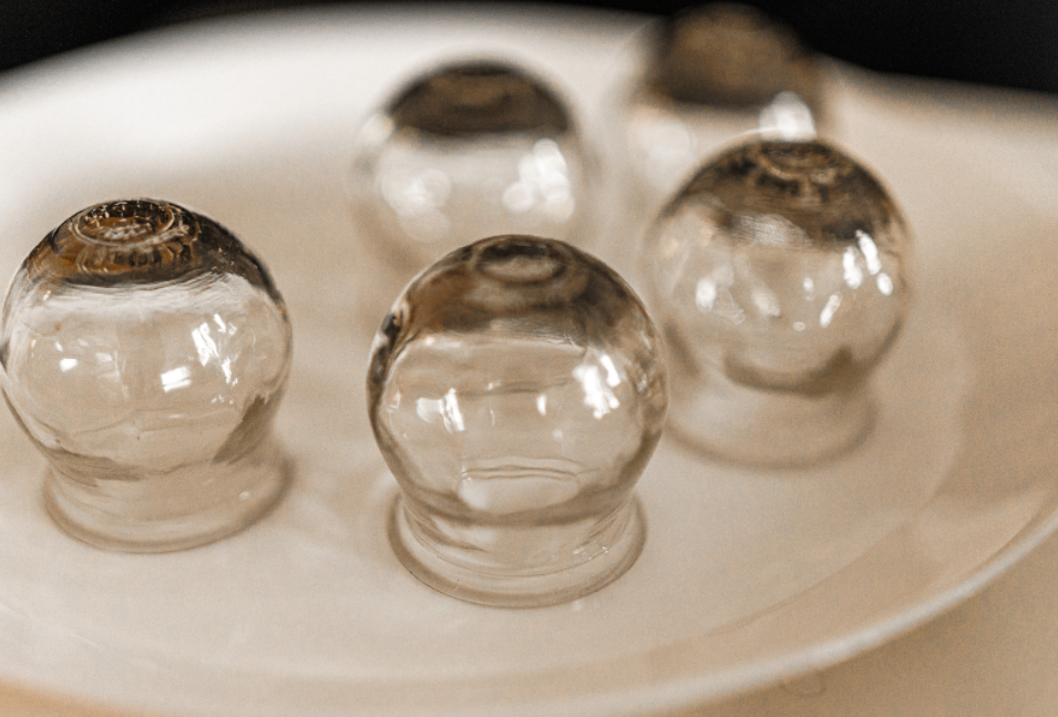 Screenshot (122) Hijama Cupping Bankstown